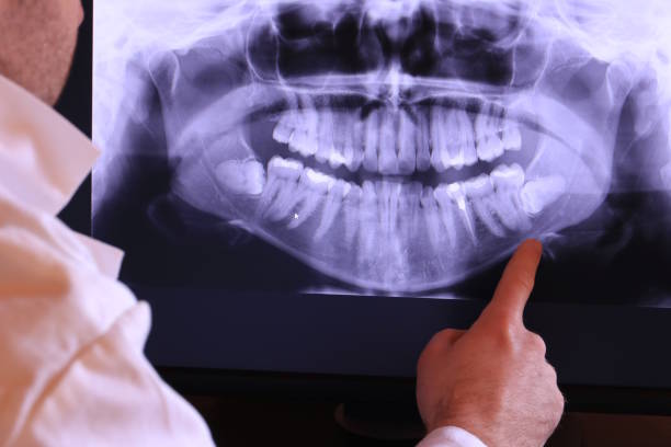 Best Emergency Tooth Extraction in Greene, RI
