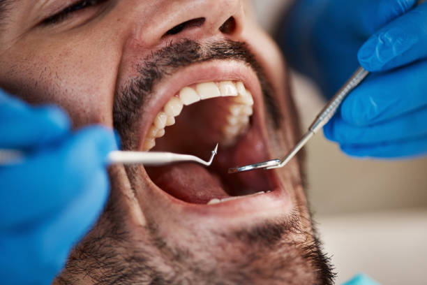 Best Emergency Tooth Extraction in Greene, RI