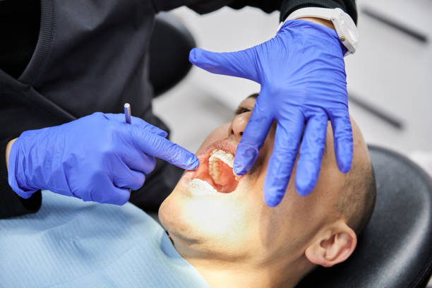Best Emergency Wisdom Teeth Removal in Greene, RI